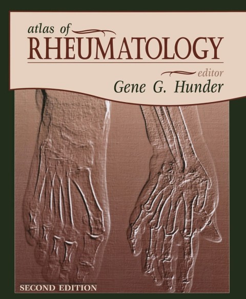 Atlas of Rheumatology, 2nd Edition - FULL INSTANT DOWNLOAD | PDF DOCX EPUB