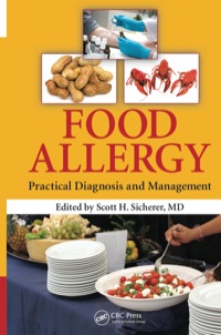 Immagine di copertina: Food Allergy 1st edition 9781466512689