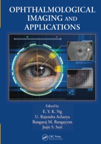 Cover image: Ophthalmological Imaging and Applications 1st edition 9781466559134
