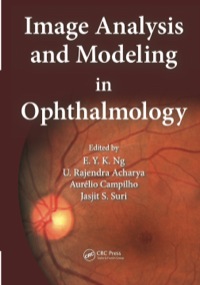 Imagen de portada: Image Analysis and Modeling in Ophthalmology 1st edition 9781466559301