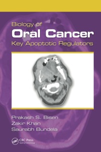 Imagen de portada: Biology of Oral Cancer 1st edition 9781466575585