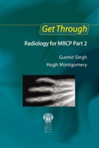Omslagafbeelding: Get Through Radiology for MRCP Part 2 1st edition 9781138451131