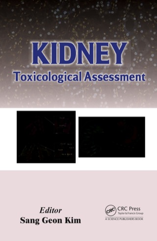 Titelbild: Kidney 1st edition 9781466588110