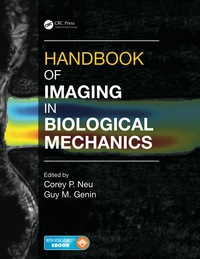 Imagen de portada: Handbook of Imaging in Biological Mechanics 1st edition 9781466588134