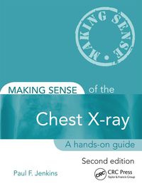 Titelbild: Making Sense of the Chest X-ray 2nd edition 9781444135152