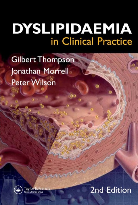 Dyslipidaemia in Clinical Practice, 2nd Edition - FULL INSTANT DOWNLOAD | PDF DOCX EPUB