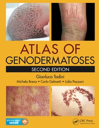 Omslagafbeelding: Atlas of Genodermatoses 2nd edition 9781466598355