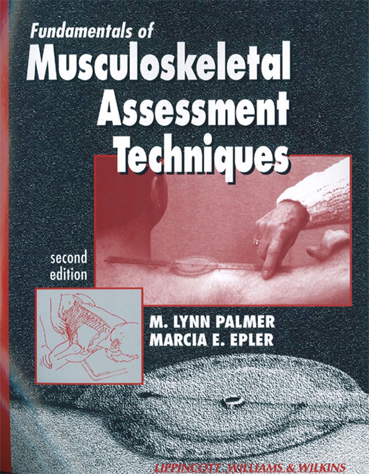 Fundamentals of Musculoskeletal Assessment Techniques 2nd Edition