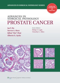 Cover image: Advances in Surgical Pathology: Prostate Cancer 1st edition 9781608314348