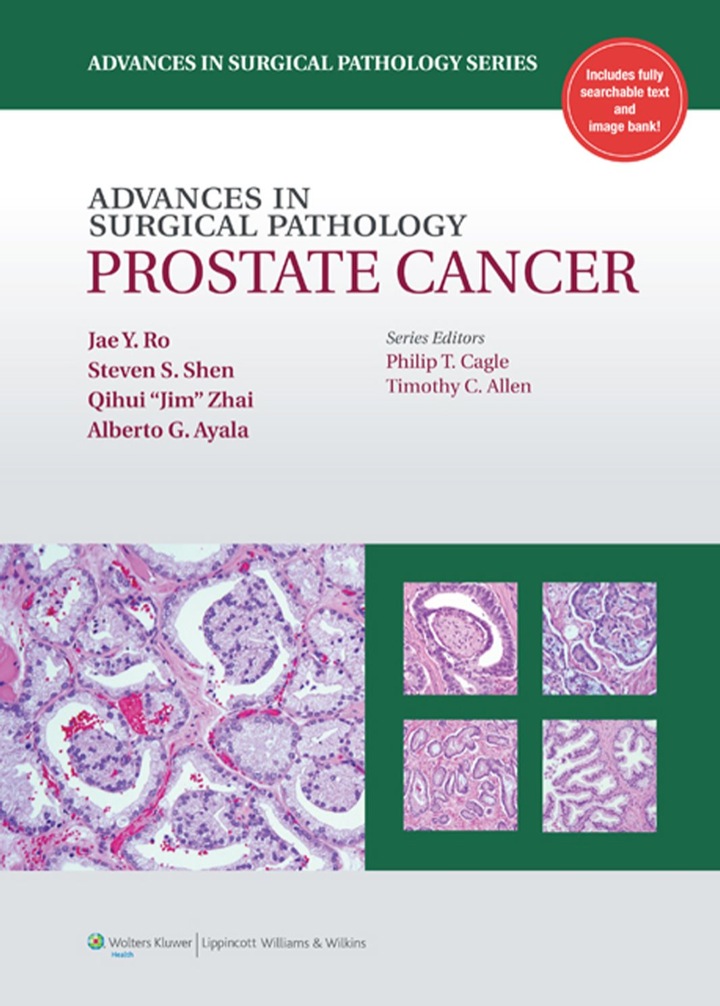 Cover image: Advances in Surgical Pathology: Prostate Cancer