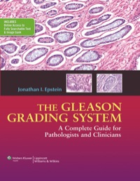 Cover image: The Gleason Grading System 1st edition 9781451172829