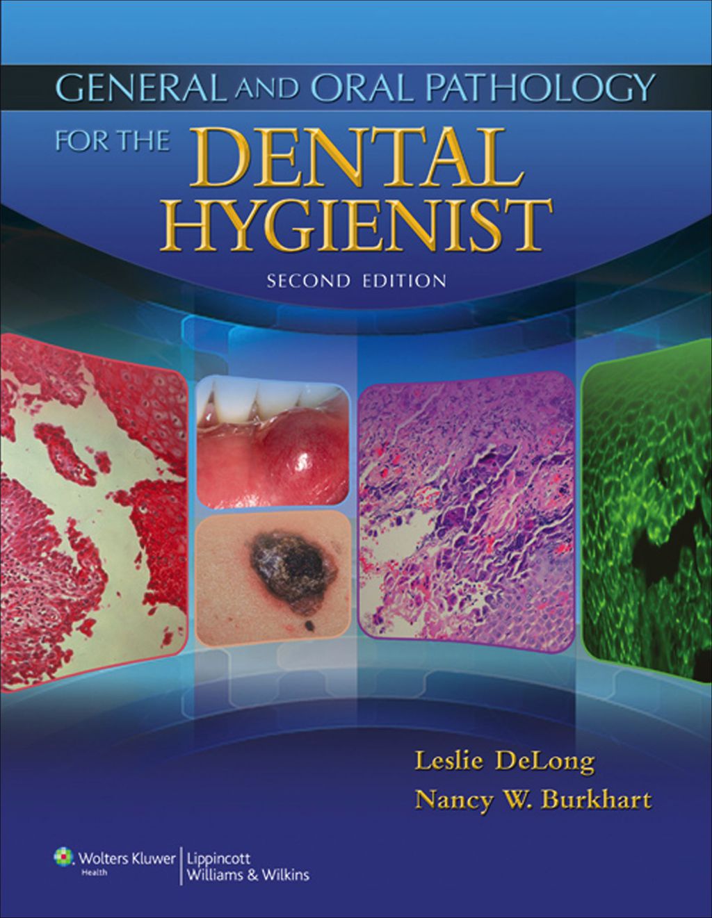 General and Oral Pathology for the Dental Hygienist 2nd Edition