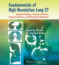 صورة الغلاف: Fundamentals of High-Resolution Lung CT: Common Findings, Common Patterns, Common Diseases, and Differential Diagnosis 1st edition 9781451184082