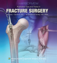 Imagen de portada: Harborview Illustrated Tips and Tricks in Fracture Surgery, Inkling 1st edition 9781605470559
