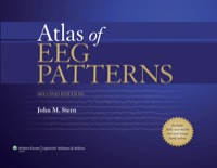 Imagen de portada: Atlas of EEG Patterns 2nd edition 9781451109634