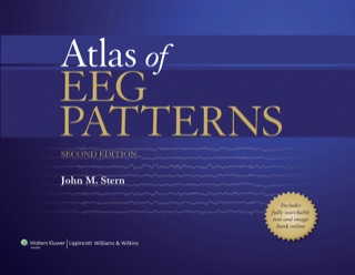 Cover image: Atlas of EEG Patterns 2nd edition 9781451109634