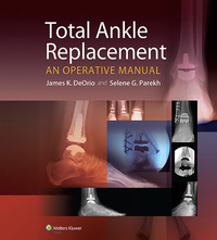 Omslagafbeelding: Total Ankle Replacement:  An Operative Manual 9781451185225