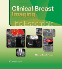 صورة الغلاف: Clinical Breast Imaging: The Essentials 9781451151770