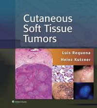 Imagen de portada: Cutaneous Soft Tissue Tumors 9781451192766