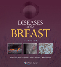 Cover image: Diseases of the Breast 5th edition 9781451186277