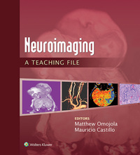 Cover image: Neuroimaging: A Teaching File 9781451173284