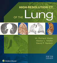 Cover image: High-Resolution CT of the Lung 5th edition 9781451176018