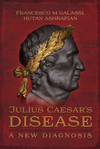 Titelbild: Julius Caesar's Disease 9781473870789