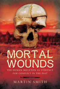 Cover image: Mortal Wounds 9781473823181