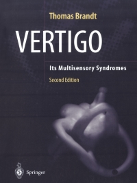 صورة الغلاف: Vertigo 2nd edition 9780387405001