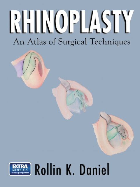 Rhinoplasty: An Atlas of Surgical Techniques - FULL INSTANT DOWNLOAD | PDF DOCX EPUB
