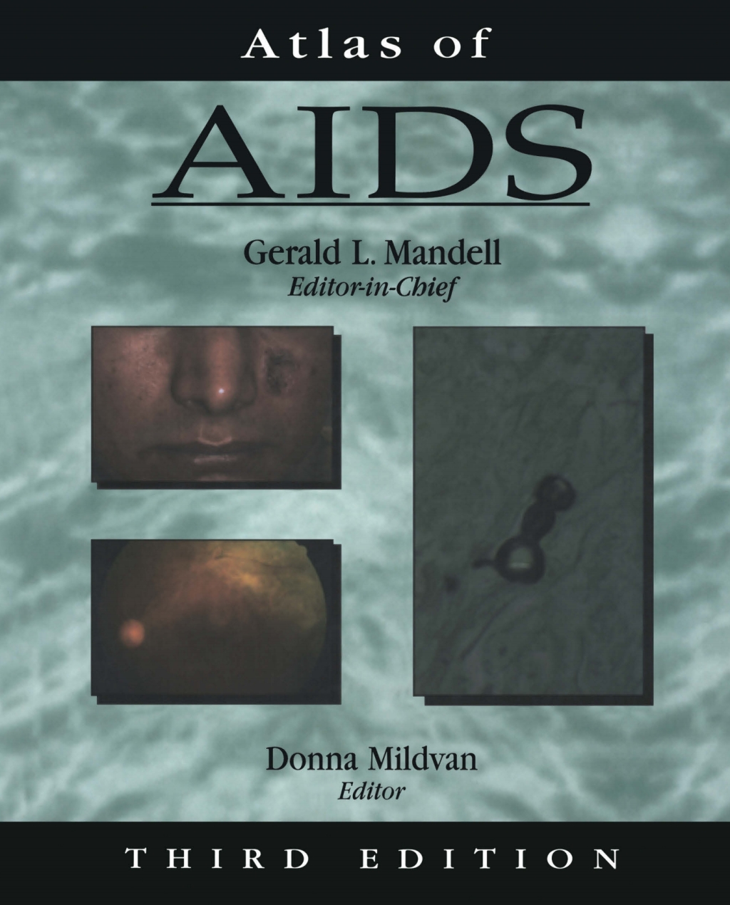 Atlas of AIDS 3rd Edition