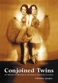 Imagen de portada: Conjoined Twins 9780786428526