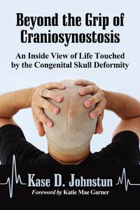 表紙画像: Beyond the Grip of Craniosynostosis 9780786475698
