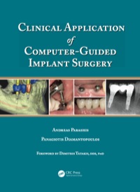 Imagen de portada: Clinical Application of Computer-Guided Implant Surgery 1st edition 9781482205411