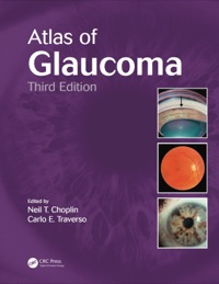 Cover image: Atlas of Glaucoma 3rd edition 9781482209211