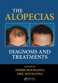 Cover image: The Alopecias 1st edition 9781482212754