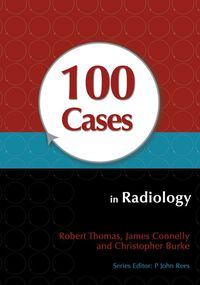 Titelbild: 100 Cases in Radiology 1st edition 9781444123319