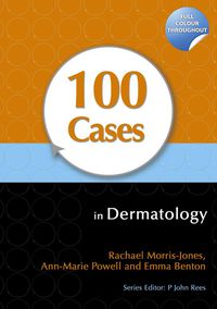 Titelbild: 100 Cases in Dermatology 1st edition 9781444117936