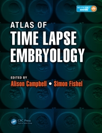 Immagine di copertina: Atlas of Time Lapse Embryology 1st edition 9781482214468
