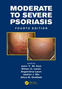Cover image: Mild to Moderate and Moderate to Severe Psoriasis (Set) 1st edition 9781482215021
