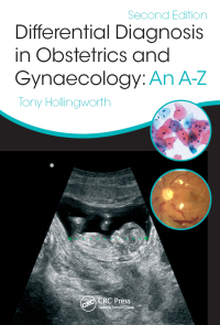 表紙画像: Differential Diagnosis in Obstetrics & Gynaecology 1st edition 9781482215298
