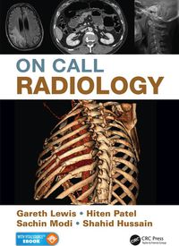 Cover image: On Call Radiology 1st edition 9781482221671