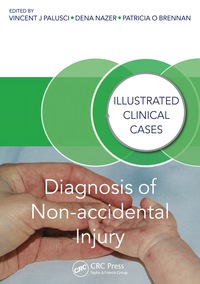 Imagen de portada: Diagnosis of Non-accidental Injury 1st edition 9781482230130