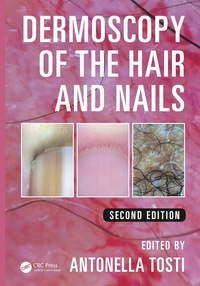 Omslagafbeelding: Dermoscopy of the Hair and Nails 2nd edition 9780367201852