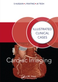 Omslagafbeelding: Cardiac Imaging 1st edition 9781482235739