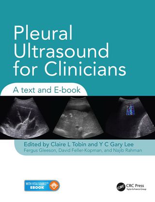 Omslagafbeelding: Pleural Ultrasound for Clinicians 1st edition 9781444166958