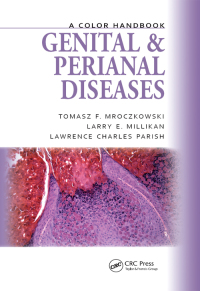 صورة الغلاف: Genital and Perianal Diseases 1st edition 9781138416697