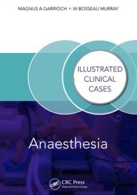 Cover image: Anaesthesia 1st edition 9781138402669