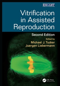 Cover image: Vitrification in Assisted Reproduction 2nd edition 9781482242577