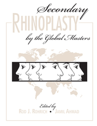 Cover image: Secondary Rhinoplasty 9781482255782